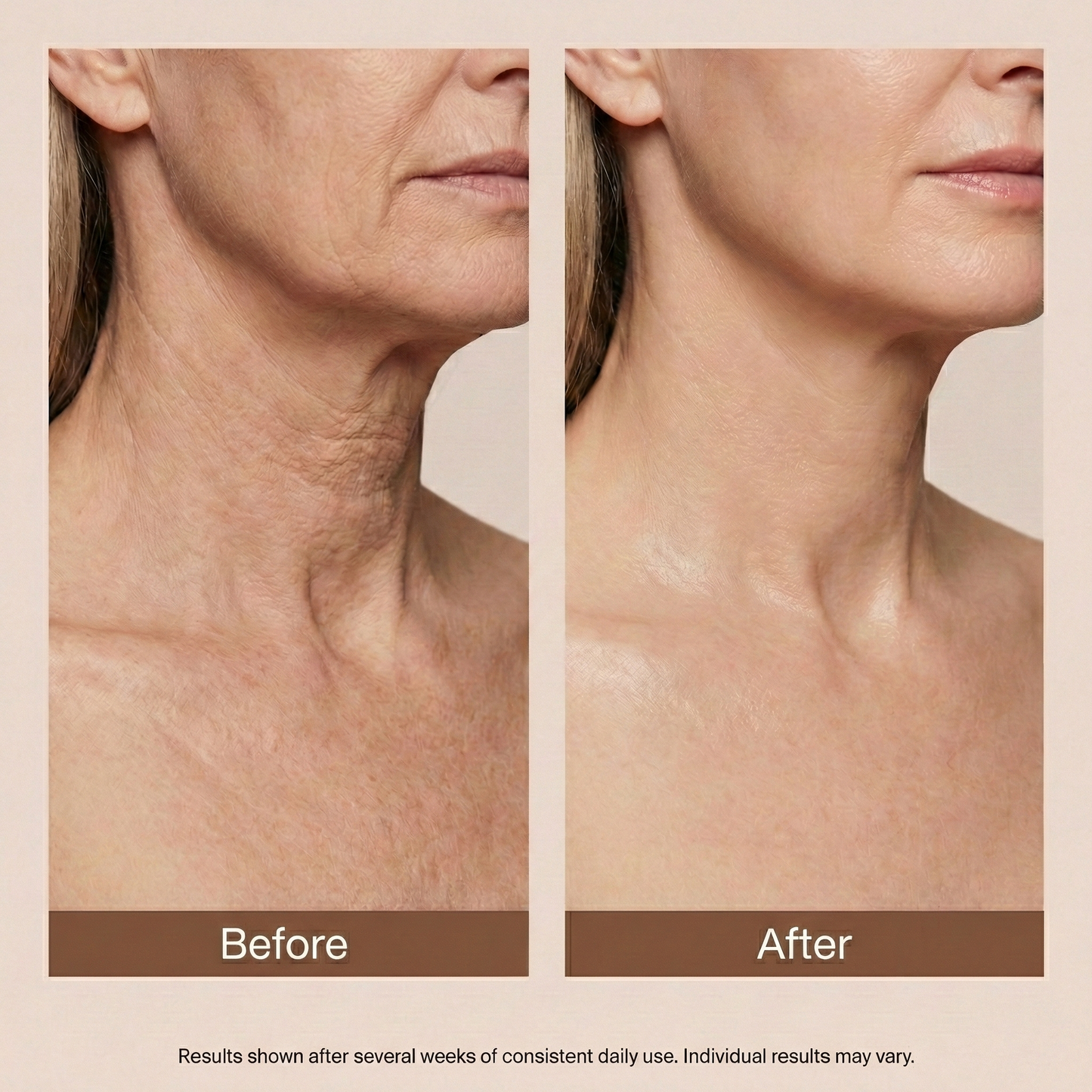 Purelle™ Lift Cream